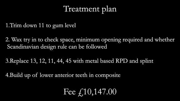 Read Newsletter 67 - Brian's COMBAT DENTURE Case Study