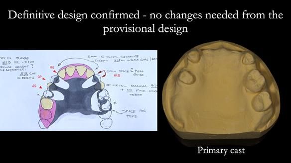 Newsletter 71 Jean’s Class I Mod III RPD: See my mistakes Fractured Mk1 to a Stronger Mk2 RPD (4 years on)