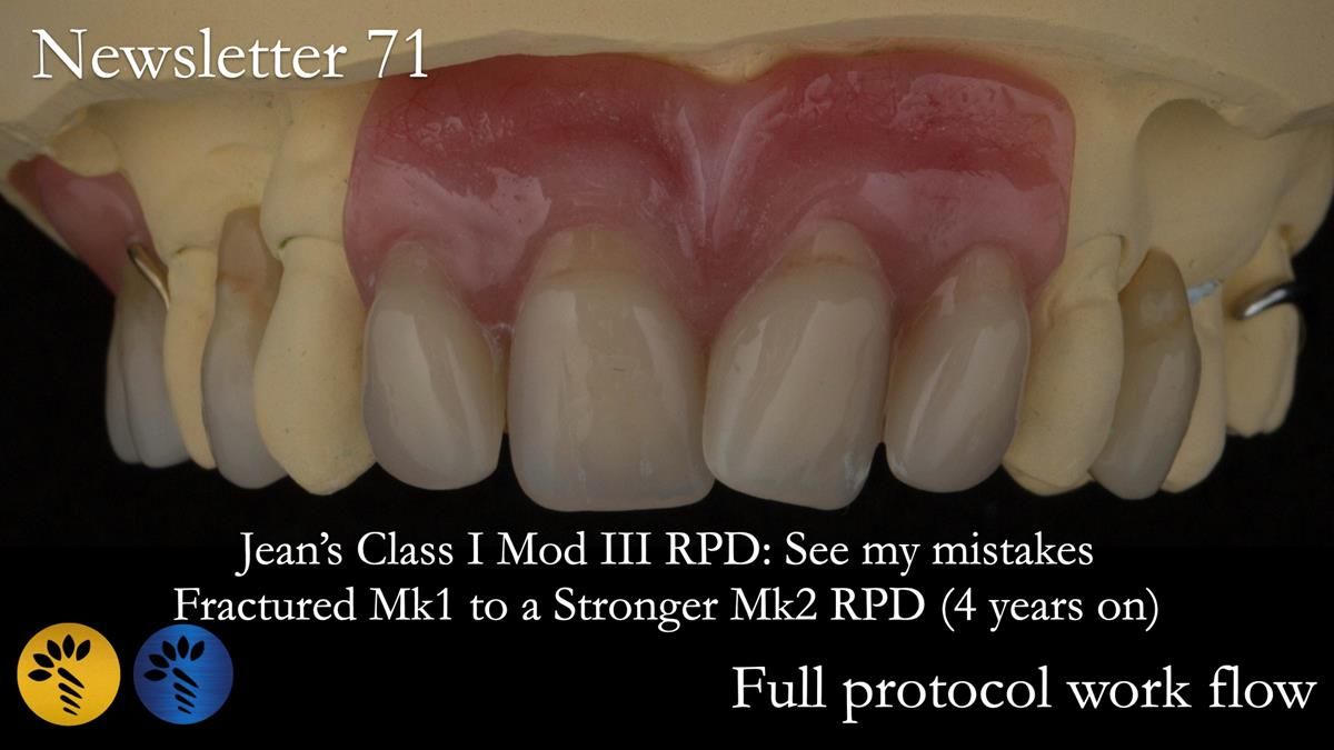 Newsletter 71 Jean’s Class I Mod III RPD: See my mistakes Fractured Mk1 to a Stronger Mk2 RPD (4 years on)