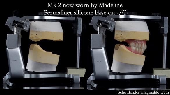 Replacing Madeline’s Complete denture FULL PROTOCOL