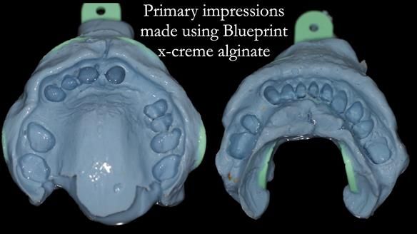 Read Newsletter 67 - Brian's COMBAT DENTURE Case Study