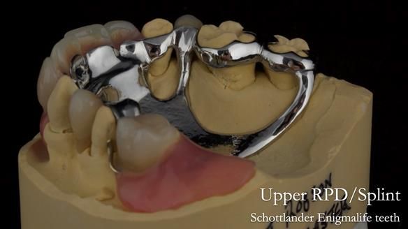 Newsletter 71 Jean’s Class I Mod III RPD: See my mistakes Fractured Mk1 to a Stronger Mk2 RPD (4 years on)