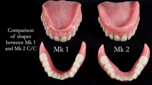 Replacing Madeline’s Complete denture FULL PROTOCOL