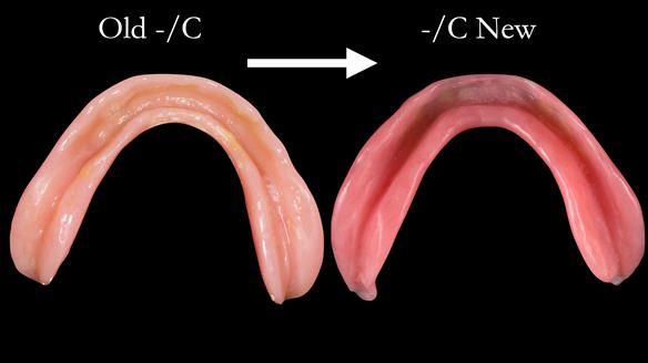 Newsletter 48 Mavis's Complete denture FULL PROTOCOL