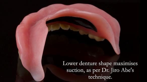 Newsletter 74: Ken’s Case Study Complete Dentures - Life Like and Age Appropriate