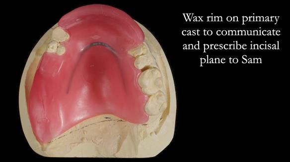 How Keith’s combat denture transformed his life – Newsletter 73