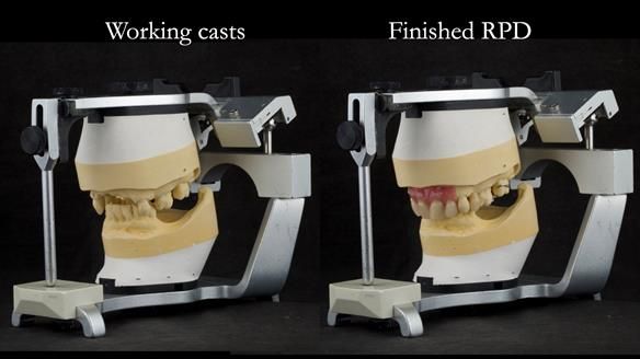 Newsletter 71 Jean’s Class I Mod III RPD: See my mistakes Fractured Mk1 to a Stronger Mk2 RPD (4 years on)