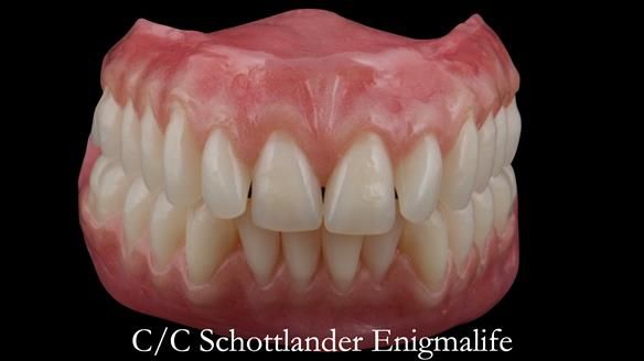 Replacing Madeline’s Complete denture FULL PROTOCOL