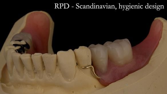 Solving Linda’s Failed “All on 4” implant bridges - full protocol Newsletter 42