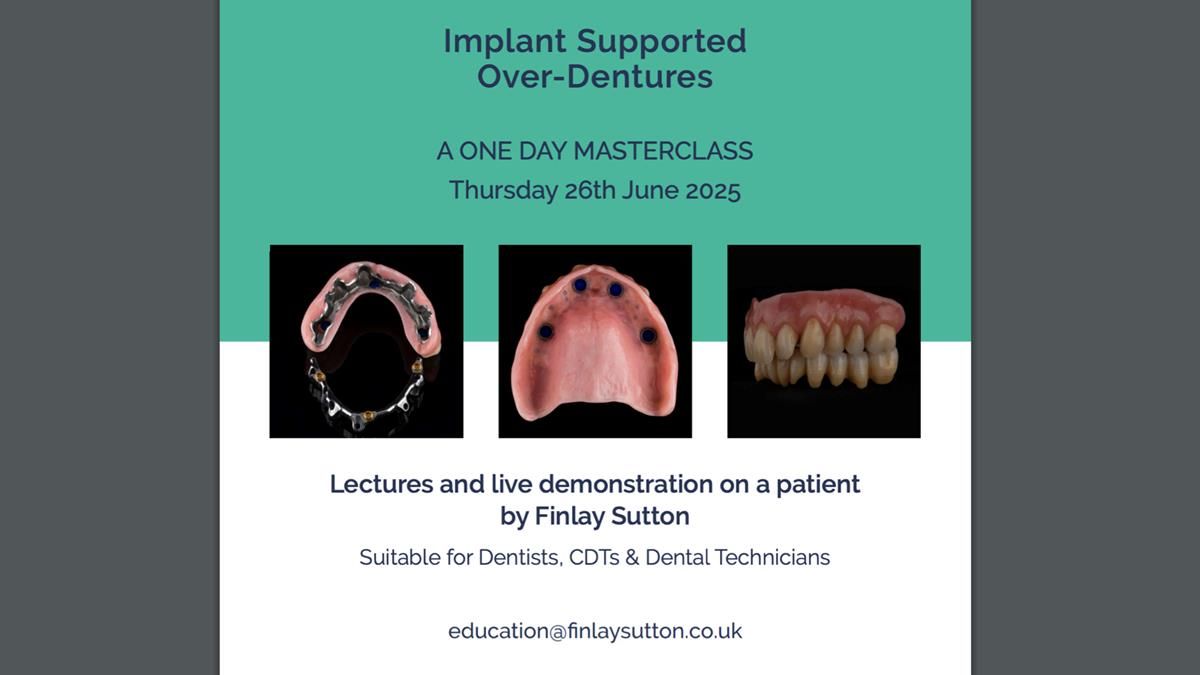 Newsletter 71 Jean’s Class I Mod III RPD: See my mistakes Fractured Mk1 to a Stronger Mk2 RPD (4 years on)