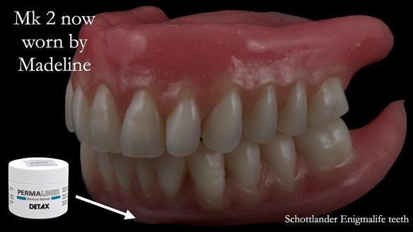 Replacing Madeline’s Complete denture FULL PROTOCOL