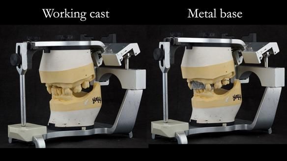 Newsletter 71 Jean’s Class I Mod III RPD: See my mistakes Fractured Mk1 to a Stronger Mk2 RPD (4 years on)