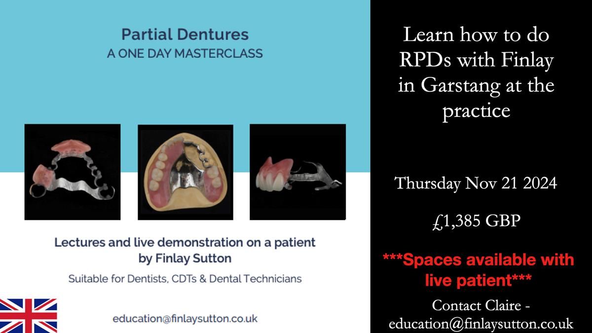 Newsletter 65 Marisa Provision of Complete Dentures on badly placed implants