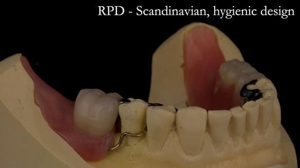 Solving Linda’s Failed “All on 4” implant bridges - full protocol Newsletter 42