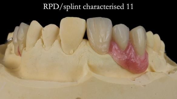 Read Newsletter 67 - Brian's COMBAT DENTURE Case Study