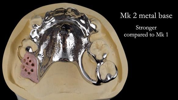 Newsletter 71 Jean’s Class I Mod III RPD: See my mistakes Fractured Mk1 to a Stronger Mk2 RPD (4 years on)