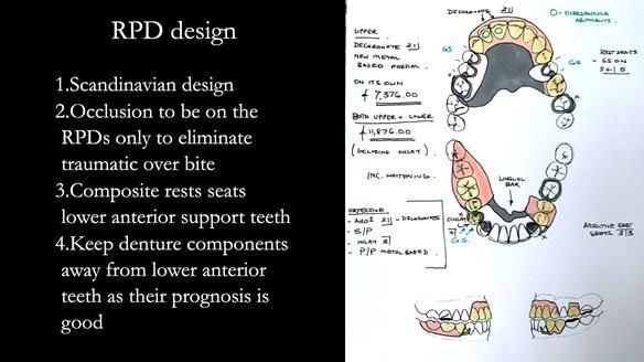 Eileen's transformation with upper and lower RPDs of Scandinavian hygienic design FULL PROTOCOL