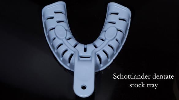 Newsletter 44 - extreme removable prosthodontics – engineering a super-strong and ultra-thin over denture