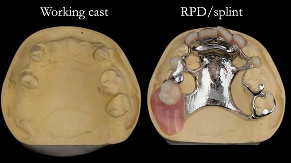 Newsletter 71 Jean’s Class I Mod III RPD: See my mistakes Fractured Mk1 to a Stronger Mk2 RPD (4 years on)