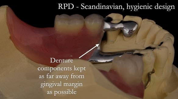 Solving Linda’s Failed “All on 4” implant bridges - full protocol Newsletter 42