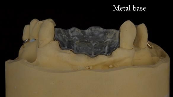 Newsletter 71 Jean’s Class I Mod III RPD: See my mistakes Fractured Mk1 to a Stronger Mk2 RPD (4 years on)