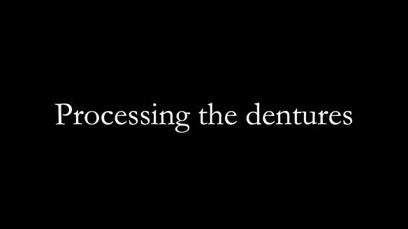 Newsletter 65 Marisa Provision of Complete Dentures on badly placed implants