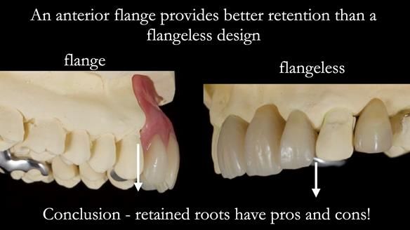 Managing Edgar “THE SCEPTIC” with an RPD/Splint FULL CASE