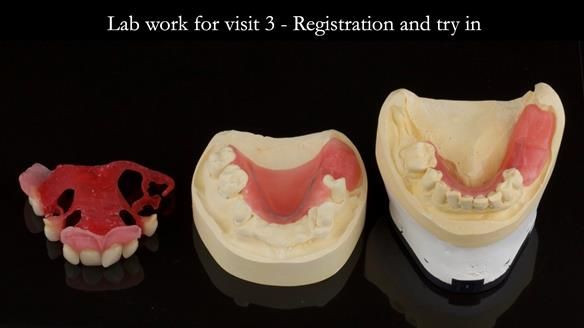 Newsletter 71 Jean’s Class I Mod III RPD: See my mistakes Fractured Mk1 to a Stronger Mk2 RPD (4 years on)