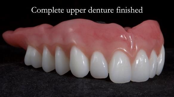 Newsletter 65 Marisa Provision of Complete Dentures on badly placed implants