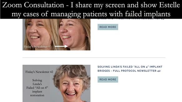 Newsletter 49 Managing Estelle’s failing implants with dentures FULL PROTOCOL