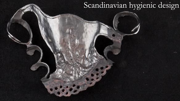 Eileen's transformation with upper and lower RPDs of Scandinavian hygienic design FULL PROTOCOL