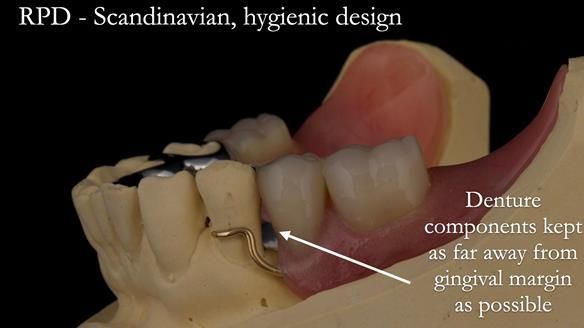 Solving Linda’s Failed “All on 4” implant bridges - full protocol Newsletter 42