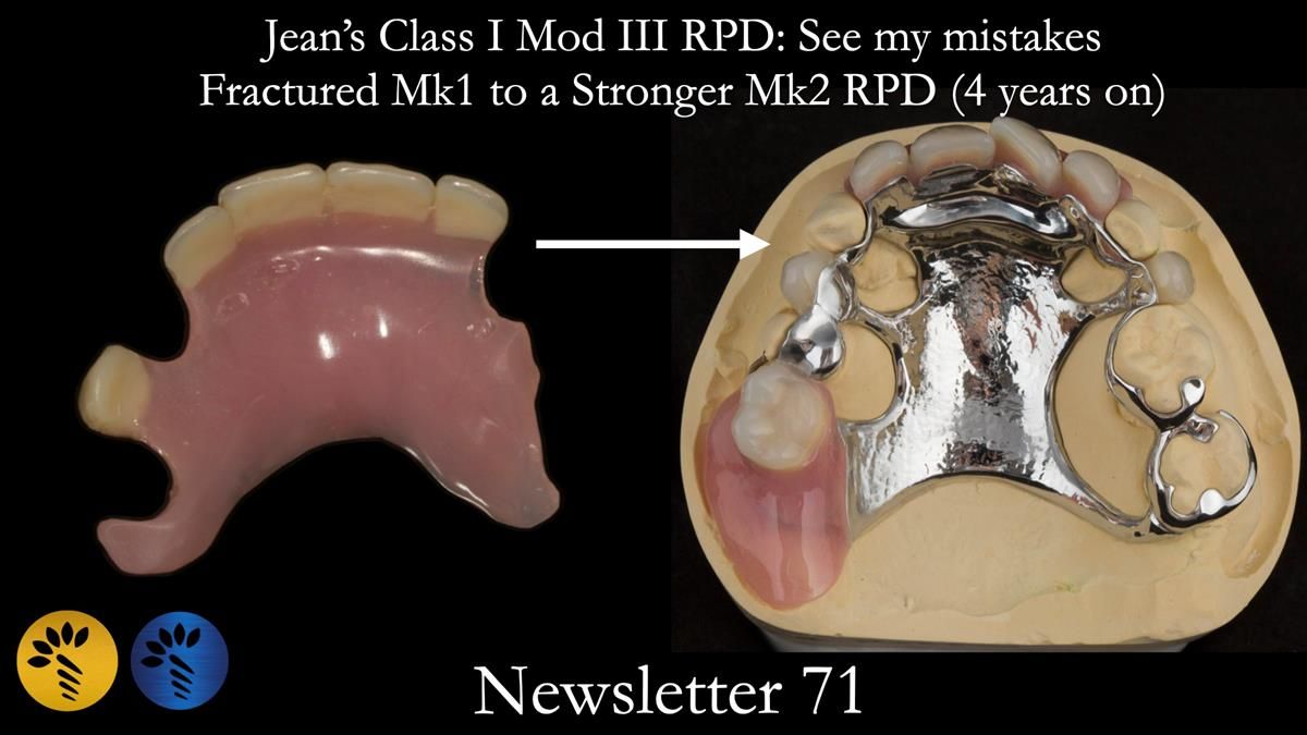 Newsletter 71 Jean’s Class I Mod III RPD: See my mistakes Fractured Mk1 to a Stronger Mk2 RPD (4 years on)