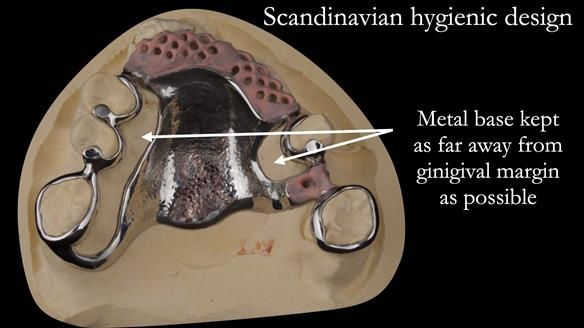 Eileen's transformation with upper and lower RPDs of Scandinavian hygienic design FULL PROTOCOL