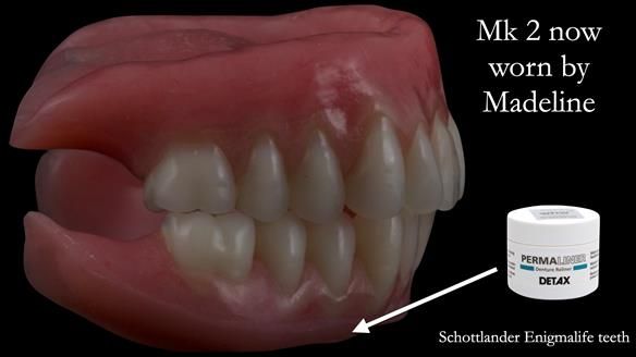 Replacing Madeline’s Complete denture FULL PROTOCOL